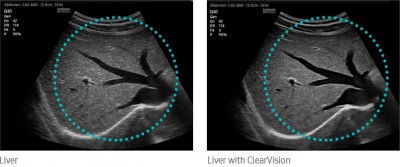 clearvision-img-md