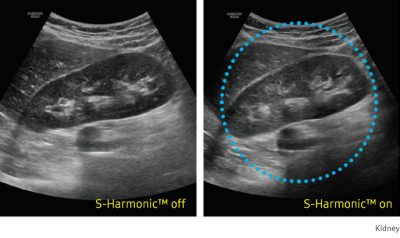 hs40_03_s-harmonic