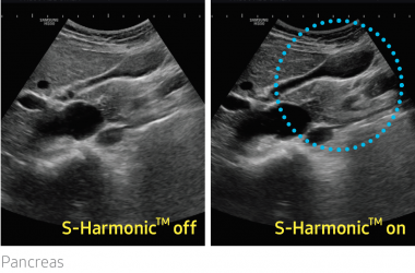 hs50_03_s-harmonic