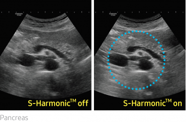 hs60_09_s-harmonic