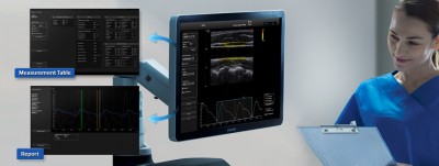 hs70_04_arterialanalysis