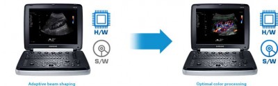 hm70_01_hybrid_beamforming_engine