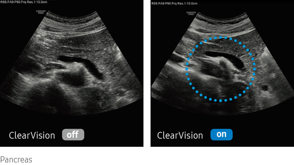 clearvision-img-lg