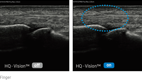 hqvision-img-lg