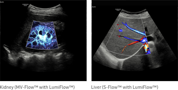 lumiflow-img-lg