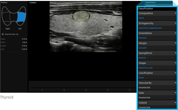 thyroid-img-lg